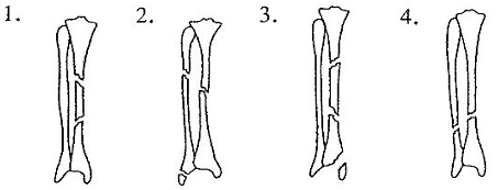 8_tߋ