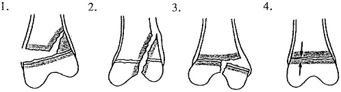 8_tߋ
