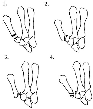 9_tߋ