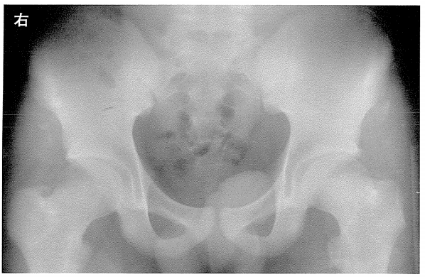 第27回柔道整復師過去問題