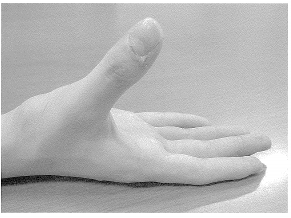 第27回柔道整復師過去問題